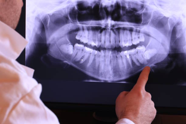 Best Weekend Emergency Dentist in Paoli, IN